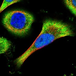 Inhibitory Synaptic Factor 1 Antibody, Novus Biologicals 25 &mu;L, Unlabeled:Antibodies,